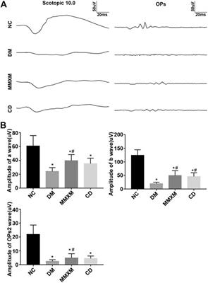 Mingmu Xiaomeng Tablets Restore Autophagy and Alleviate Diabetic Retinopathy by Inhibiting PI3K/Akt/mTOR Signaling